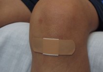 16 個夢見被咬的象徵和含義解釋