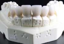 9 個夢見假牙的解釋：夢見失去假牙 、 夢見製作假牙